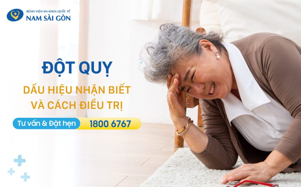 đột quỵ là gì