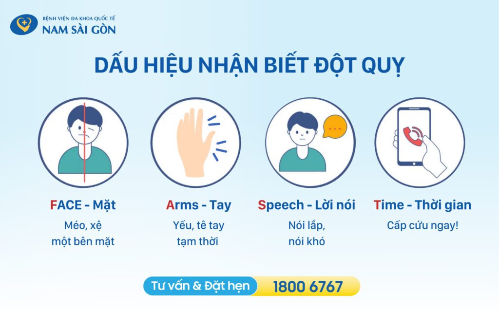 Dấu hiệu nhận biết đột quỵ.