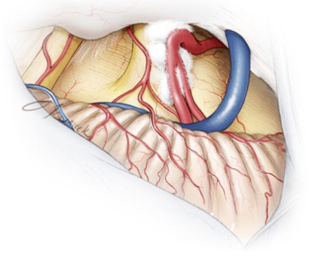 dây thần kinh tam thoa