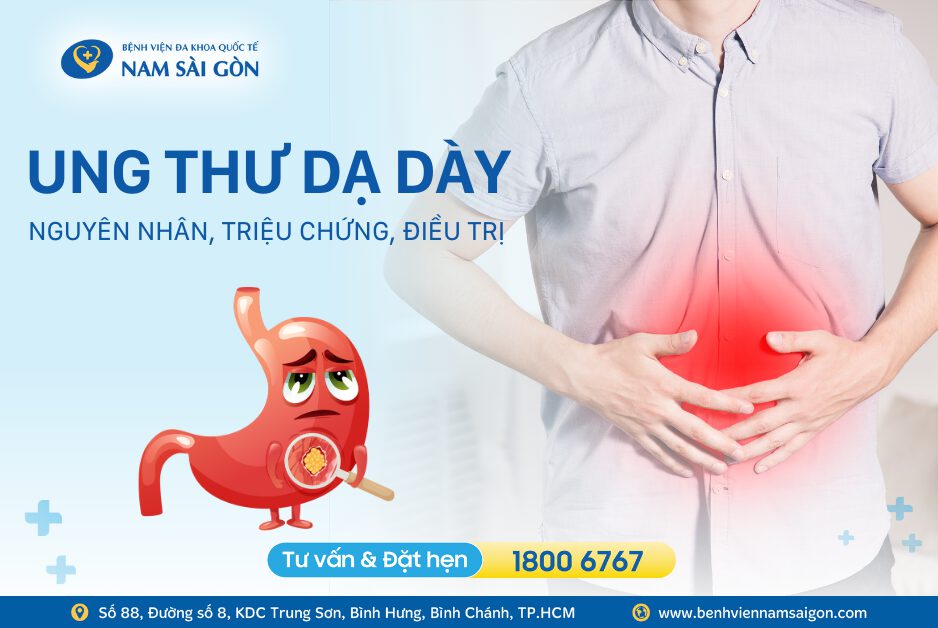 UNG THƯ DẠ DÀY – NGUYÊN NHÂN, TRIỆU CHỨNG VÀ CÁCH ĐIỀU TRỊ