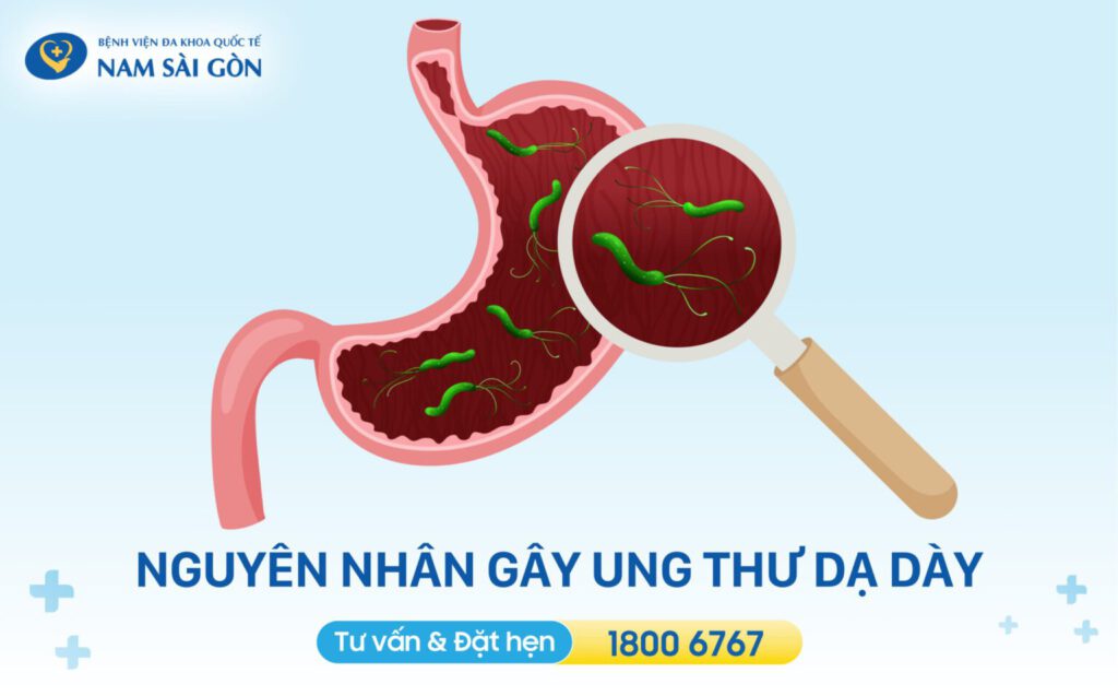 nguyên nhân ung thư dạ dày