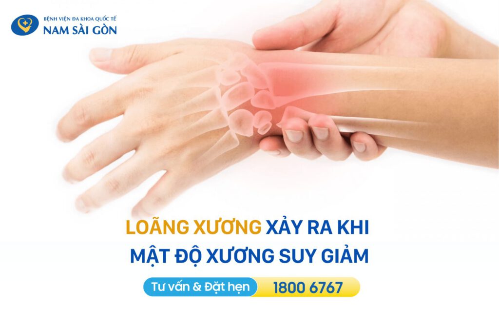 Loãng xương là gì