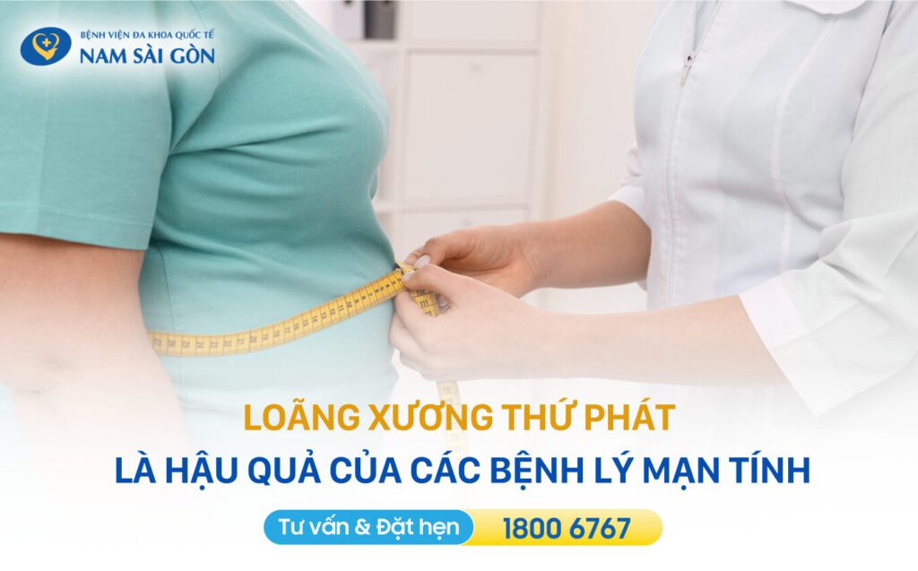 Phân loại loãng xương