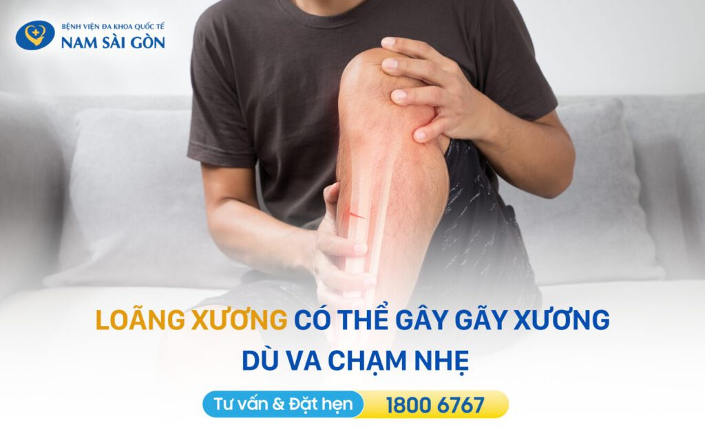 Loãng xương có nguy hiểm không