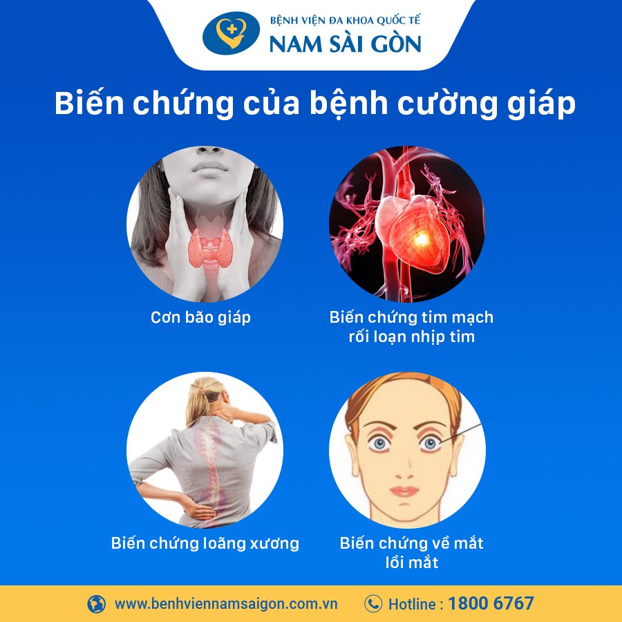 Biến Chứng Của Bệnh Cường Giáp