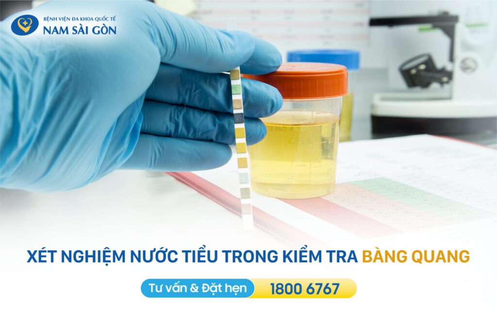 kiểm tra bàng quang trong khám tiết niệu