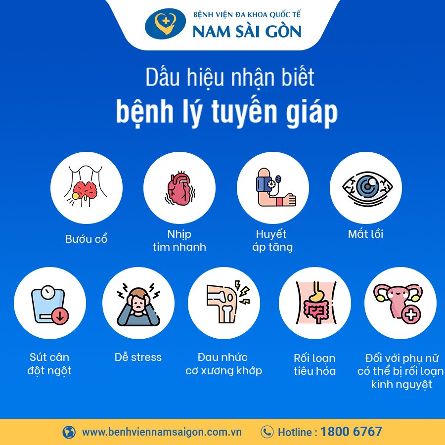 dấu hiệu cường giáp dấu hiệu bị cường giáp