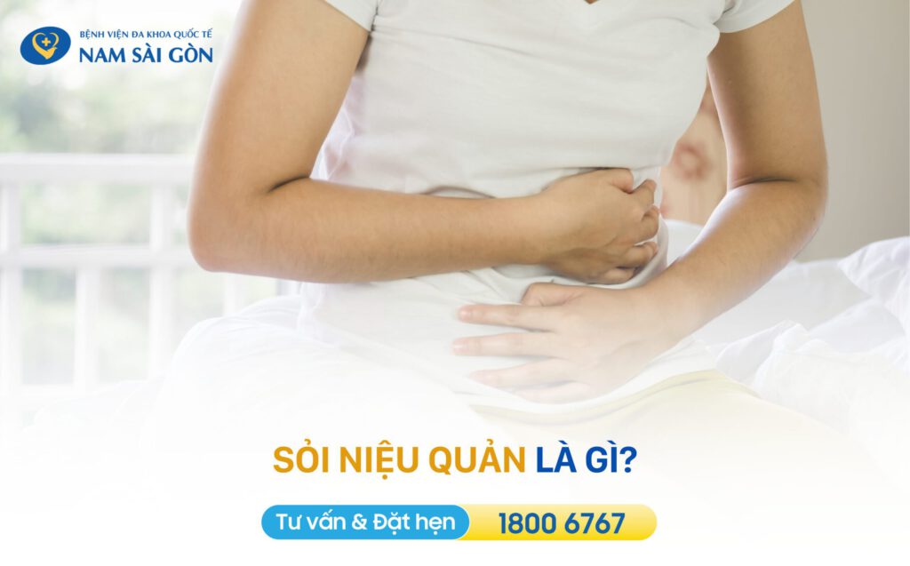 bệnh sỏi niệu quản sỏi niệu quản là gì