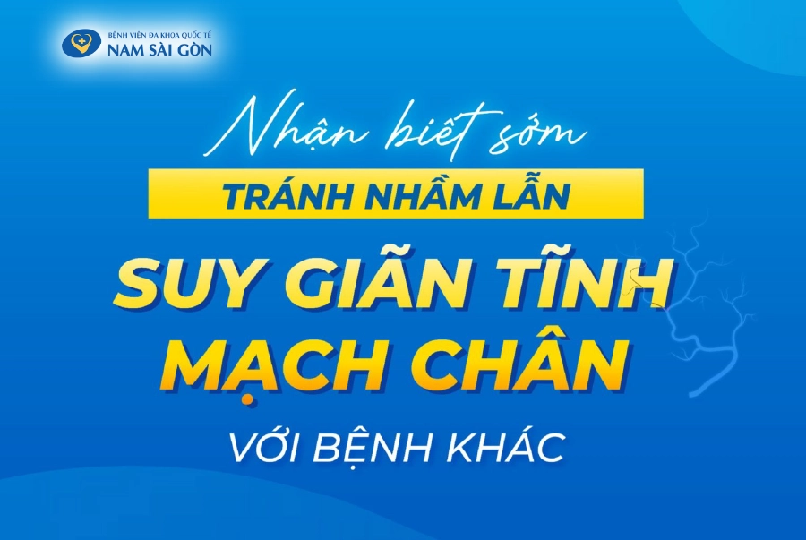 NHẬN BIẾT SỚM TRÁNH NHẦM LẪN SUY GIÃN TĨNH MẠCH CHÂN VỚI BỆNH KHÁC
