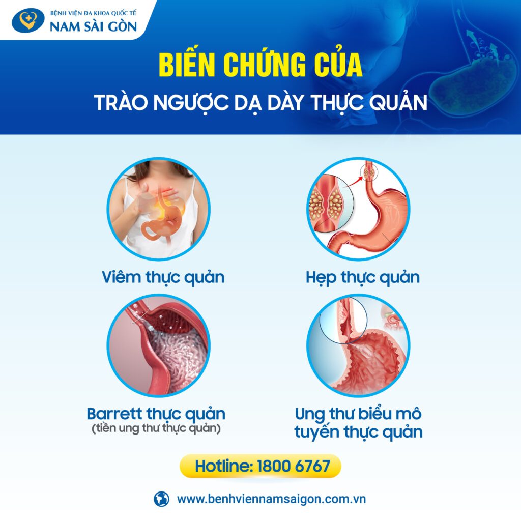 nguyên nhân gây trào ngược dạ dày Biến chứng của trào ngược dạ dày thực quản
