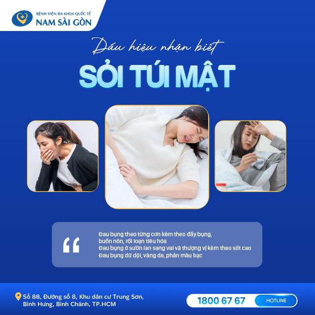 nguyên nhân sỏi túi mật Dấu hiệu nhận biết sỏi túi mật