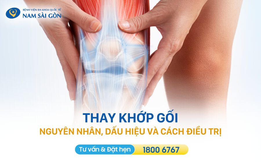 thay khớp gối
