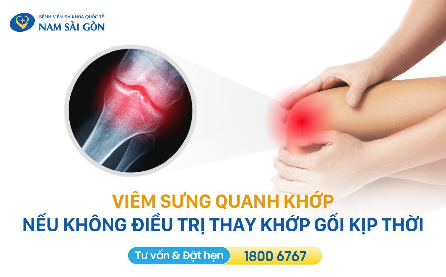 Các biến chứng sau khi phẫu thuật thay khớp gối
