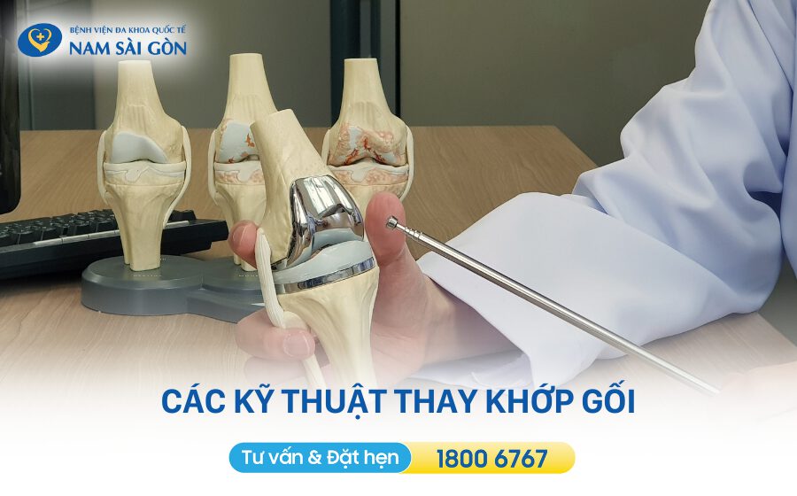 Kỹ thuật thay khớp gối