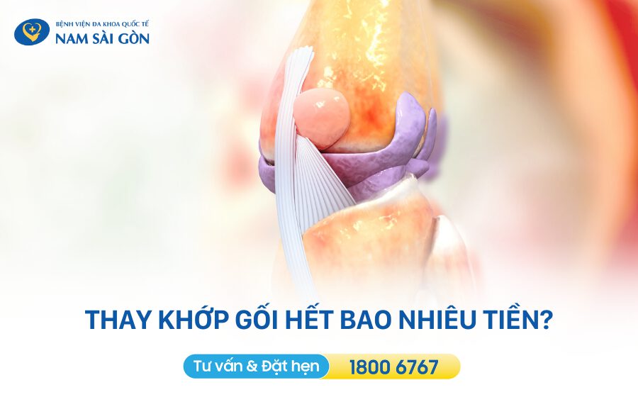 thay khớp gối hết bao nhiêu tiền
