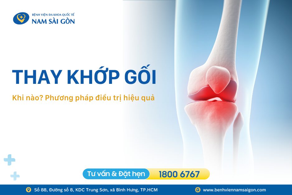 THAY KHỚP GỐI LÀ GÌ? KHI NÀO CẦN THAY KHỚP GỐI?