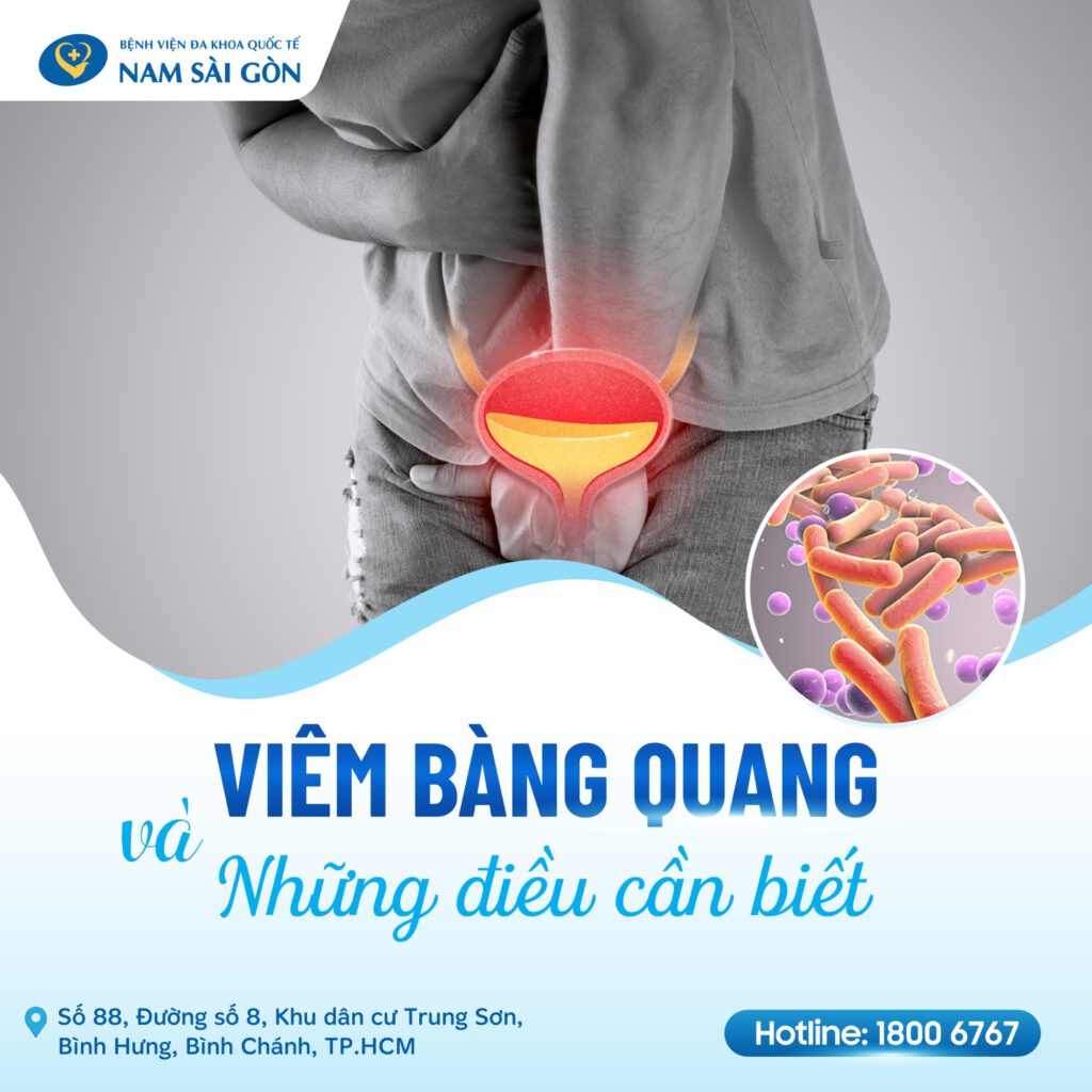 viêm bàng quang cấp Viêm bàng quang cấp tính là gì