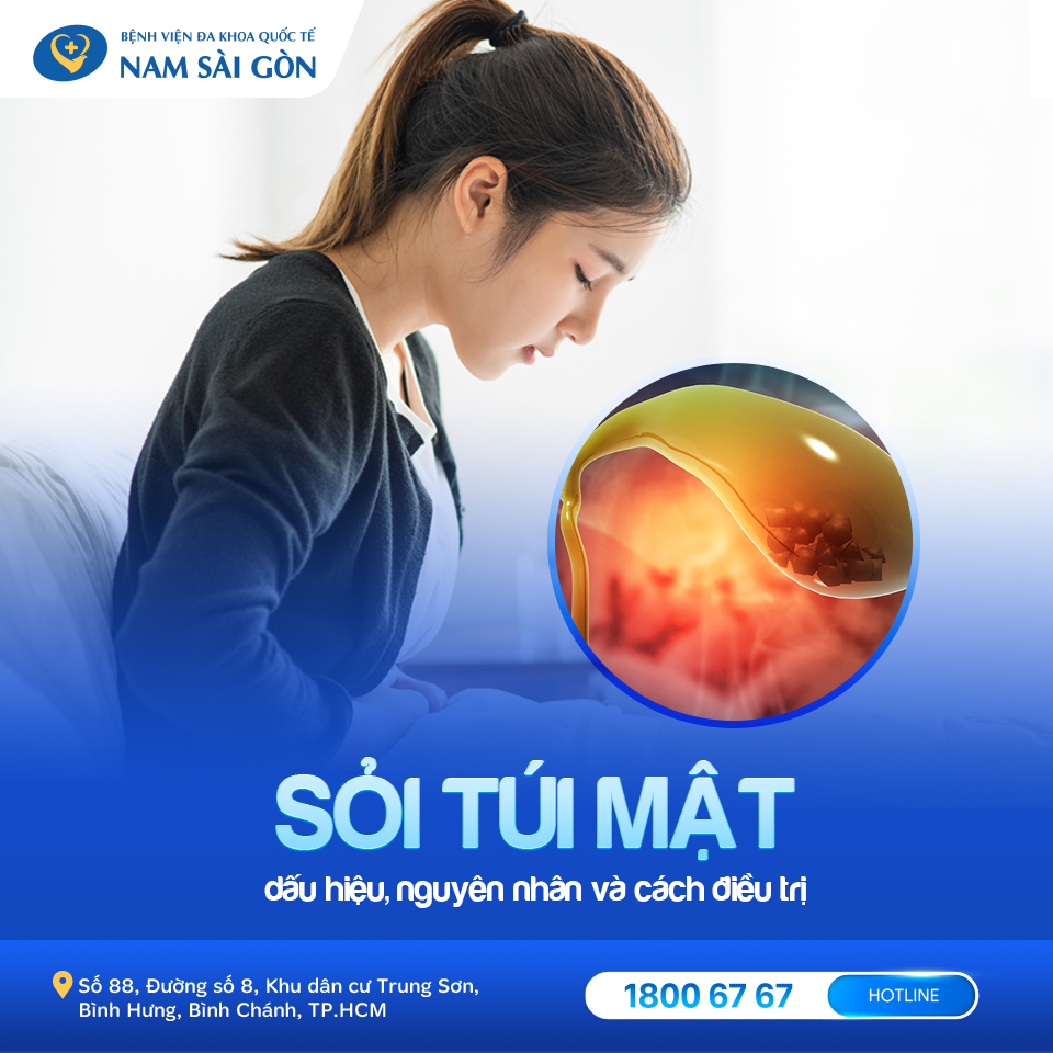 sỏi túi mật là gì