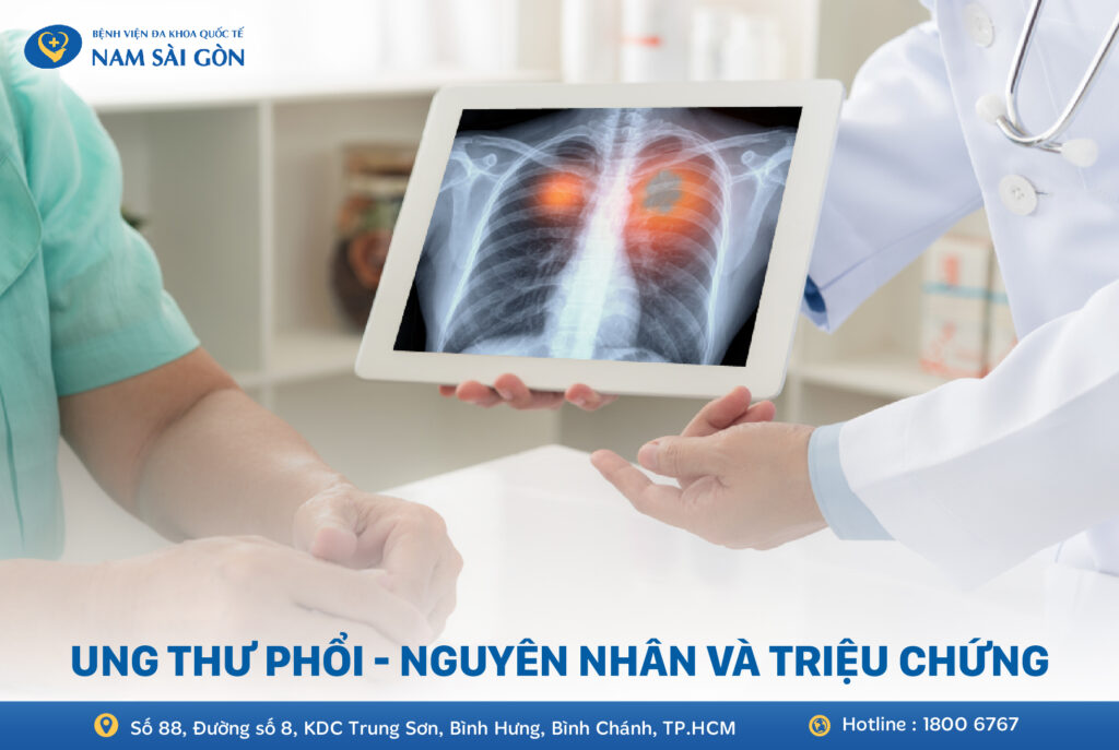 Ung thư phổi là gì