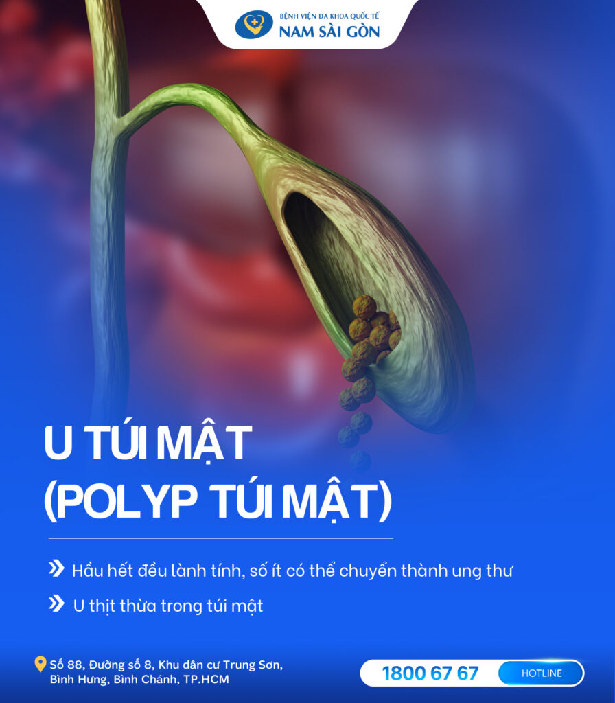 u túi mật có nguy hiểm không