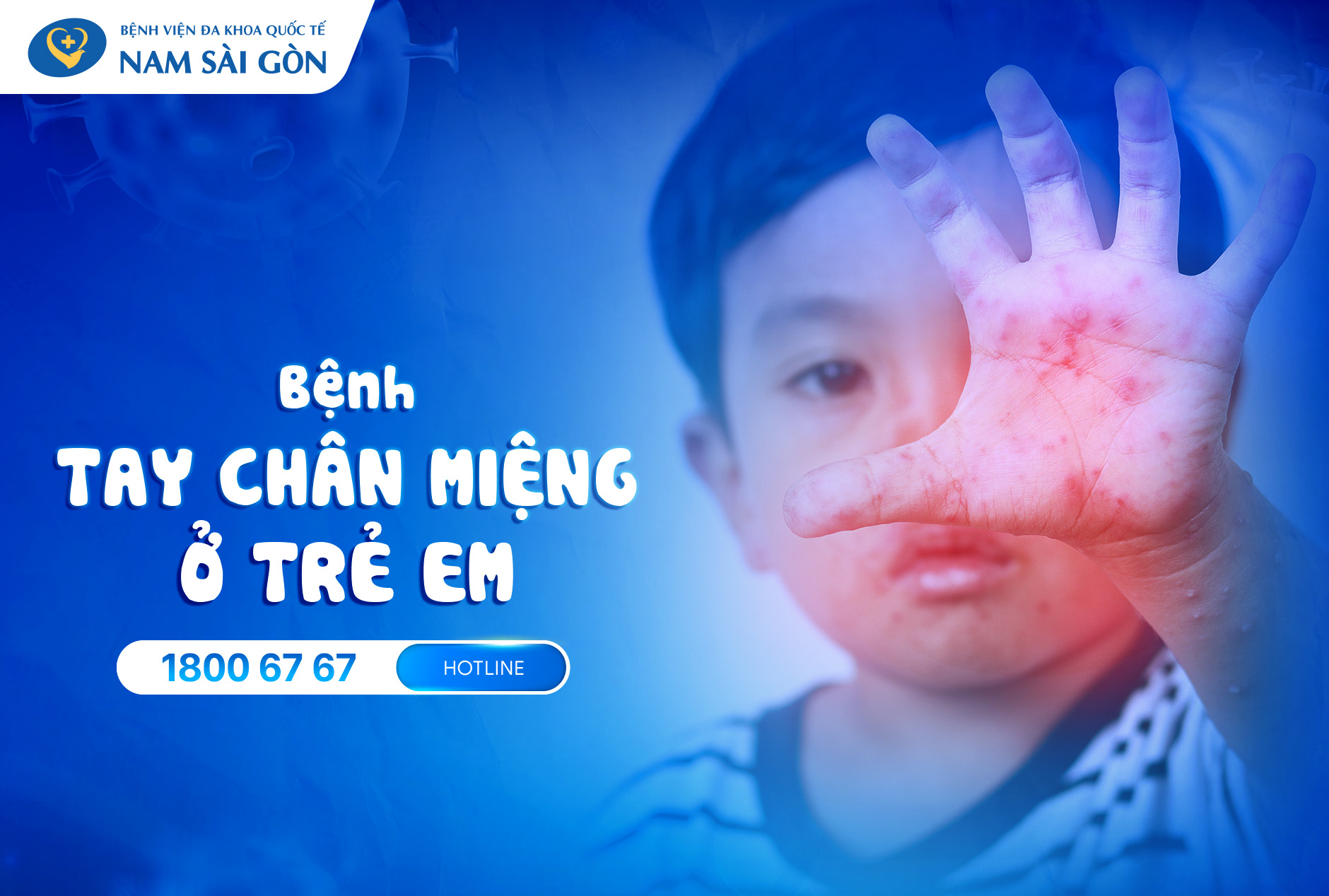 BỆNH CHÂN TAY MIỆNG: CHUẨN ĐOÁN, ĐIỀU TRỊ VÀ CÁCH PHÒNG BỆNH
