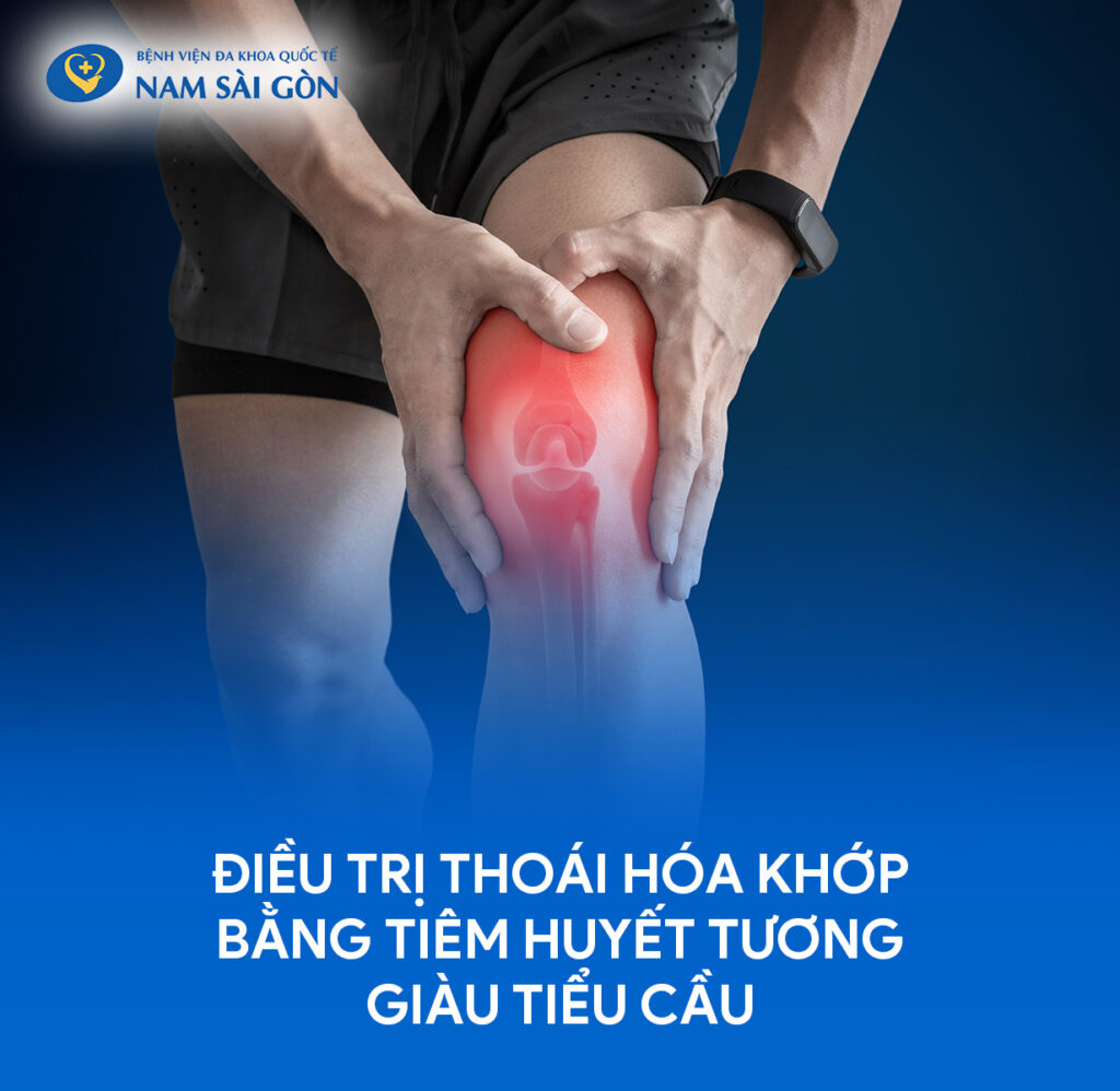 chi phí tiêm huyết tương giàu tiểu cầu phương pháp prp huyết tương giàu tiểu cầu