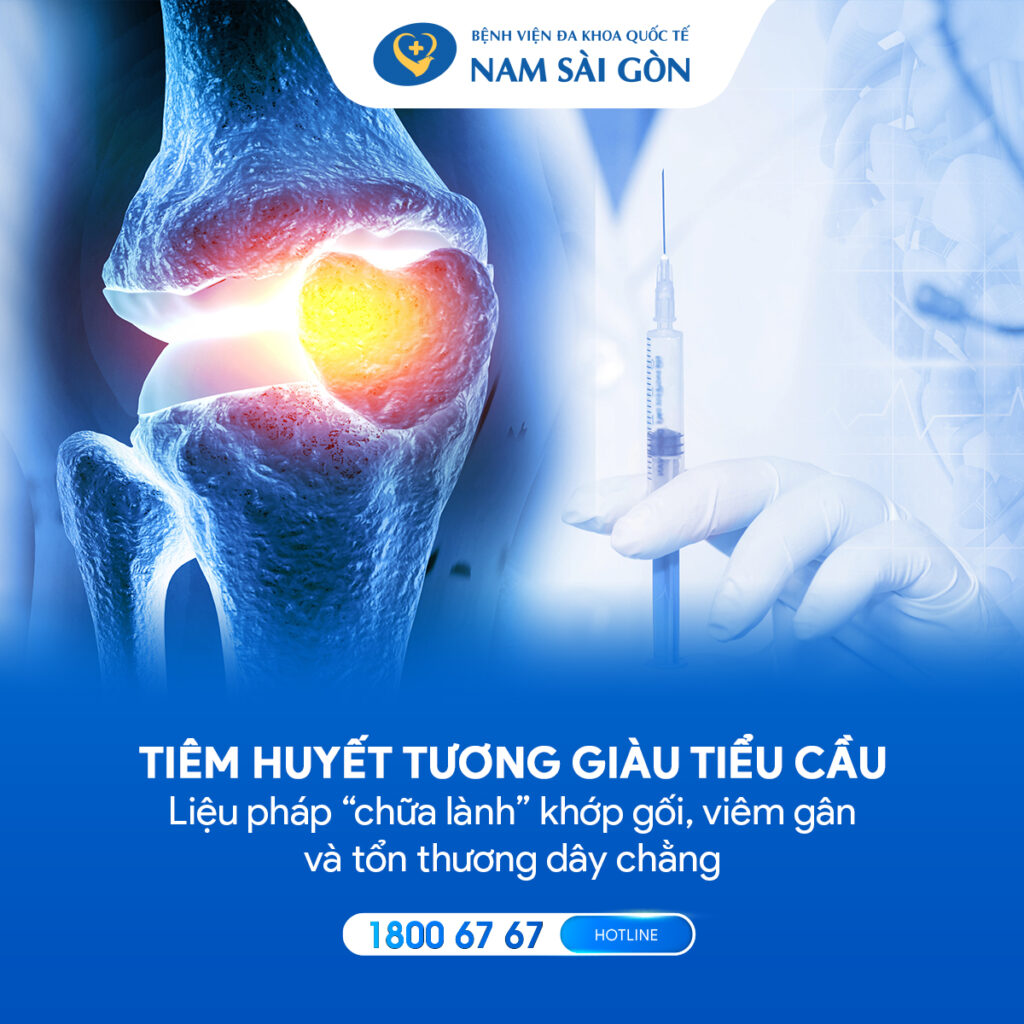 giá 1 mũi tiêm huyết tương giàu tiểu cầu tiêm huyết tương giàu tiểu cầu