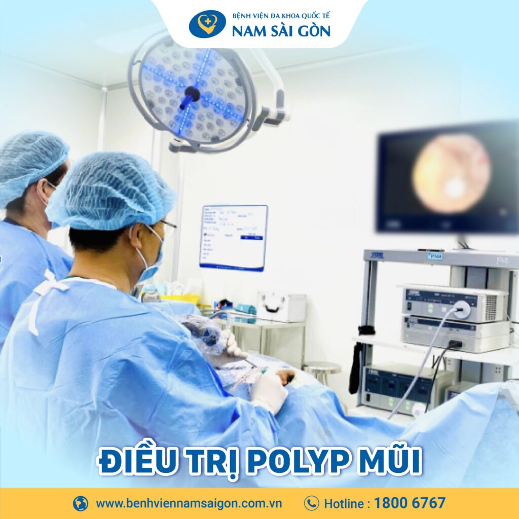 cách chữa polyp mũi bằng dân gian Điều trị polyp mũi