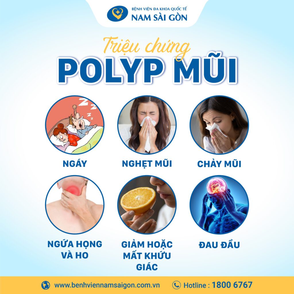 bệnh polyp mũi triệu chứng polyp mũi