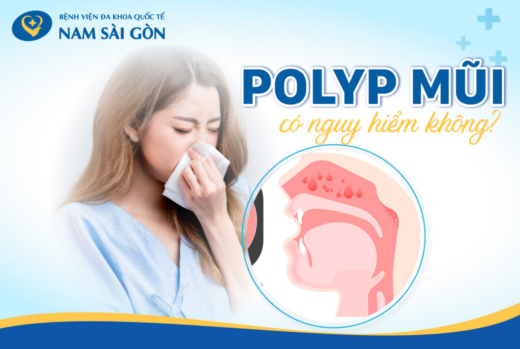 hình ảnh polyp mũi polyp mũi là gì