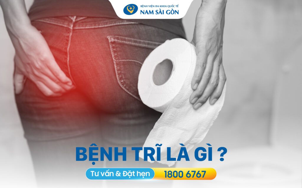 Bệnh trĩ là gì