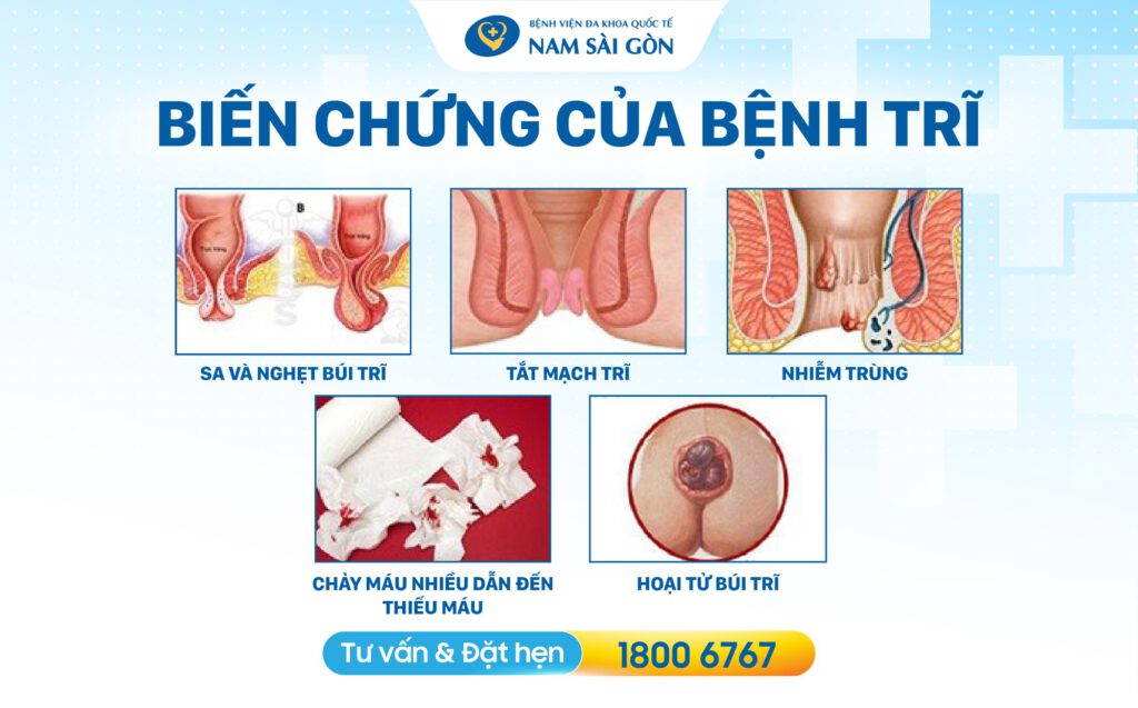 Biến chứng của bệnh trĩ