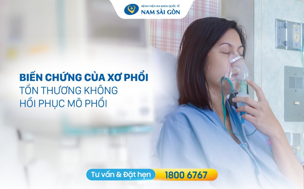 xơ hóa phổi Biến chứng xơ hóa phổi nguy hiểm
