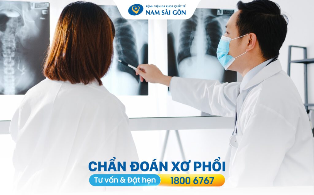 xơ phổi có nguy hiểm không Chẩn đoán xơ phổi