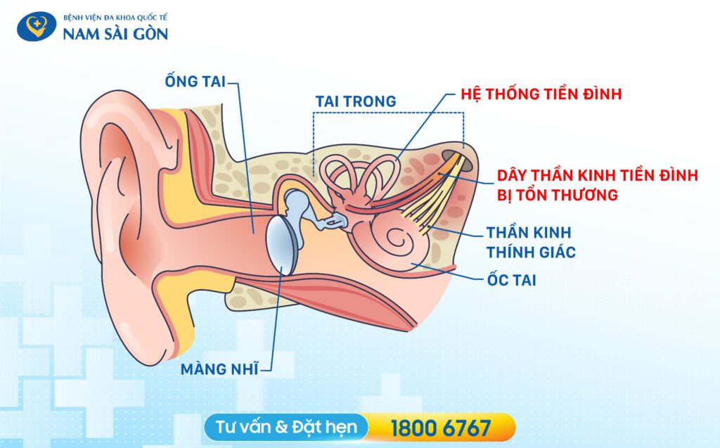 roi loan tien dinh la gi bị tiền đình là gì