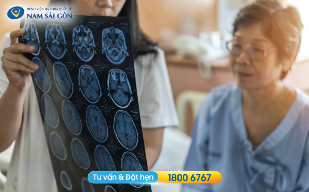 tai biến thoáng qua