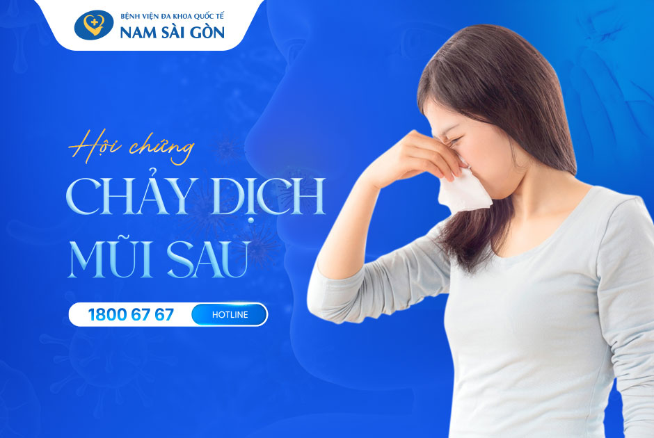 HỘI CHỨNG CHẢY DỊCH MŨI SAU – NGUYÊN NHÂN, BIỂU HIỆN VÀ ĐIỀU TRỊ