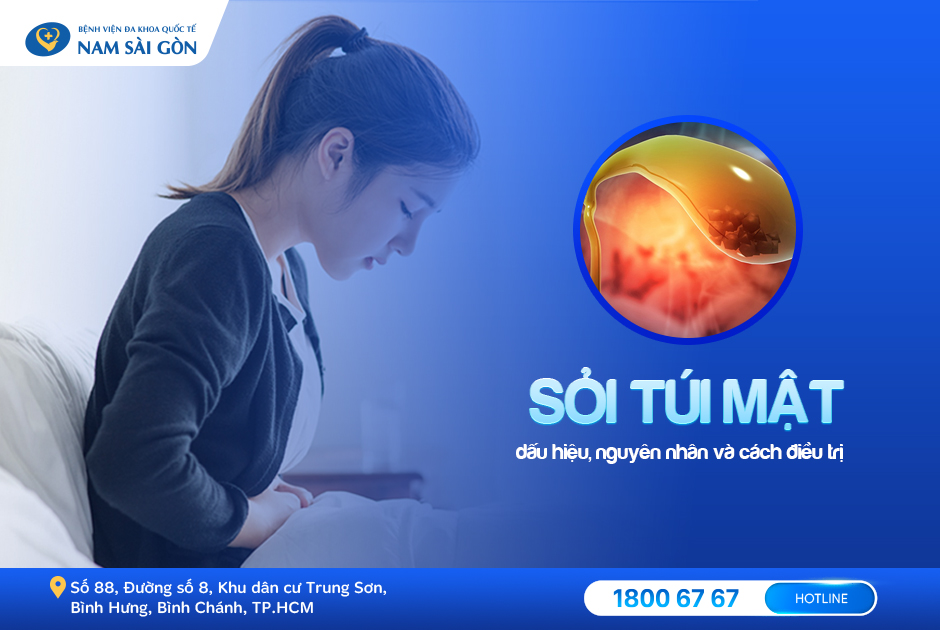 SỎI TÚI MẬT – DẤU HIỆU, NGUYÊN NHÂN, BIẾN CHỨNG VÀ CÁCH ĐIỀU TRỊ