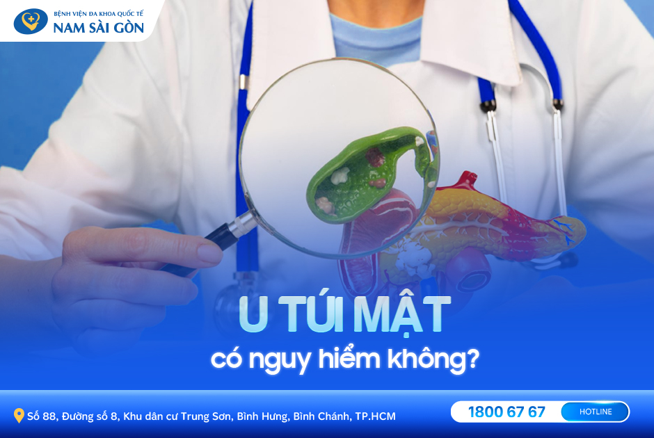 U TÚI MẬT – NGUYÊN NHÂN, TRIỆU CHỨNG VÀ CÁCH ĐIỀU TRỊ