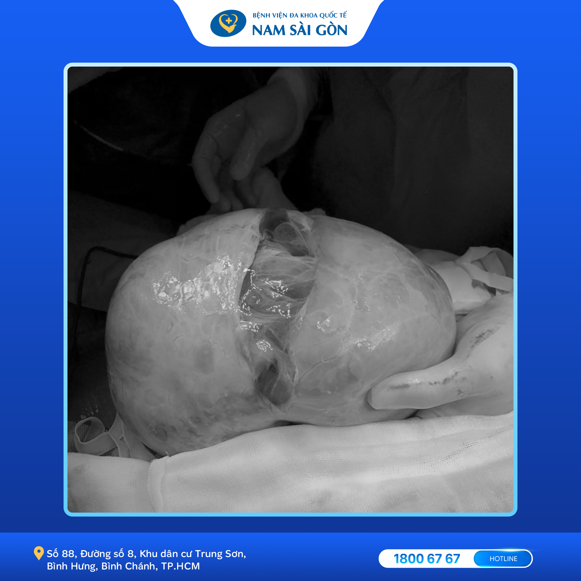 1689_hinhwweb-1 1689 hinhwweb 1