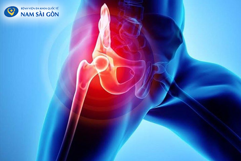 PHẪU THUẬT THAY KHỚP HÁNG VÀ NHỮNG ĐIỀU CẦN BIẾT