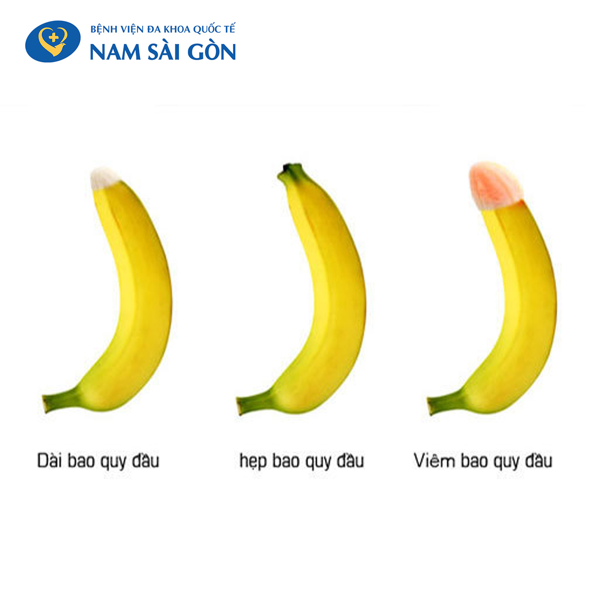 cắt bao quy đầu xong có đau không