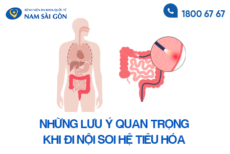 NỘI SOI TIÊU HÓA LÀ GÌ? NHỮNG LƯU Ý QUAN TRỌNG KHI ĐI NỘI SOI TIÊU HÓA