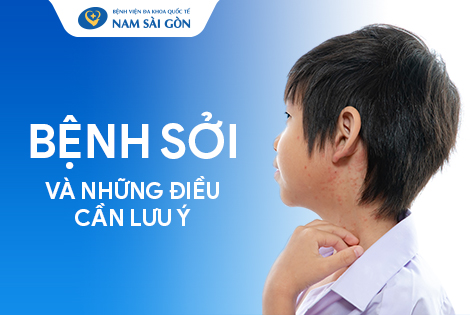 BỆNH SỞI – NGUYÊN NHÂN, TRIỆU CHỨNG, CHẨN ĐOÁN VÀ CÁCH ĐIỀU TRỊ
