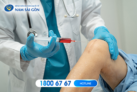 HUYẾT TƯƠNG GIÀU TIỂU CẦU TRONG ĐIỀU TRỊ THOÁI HÓA KHỚP (PRP)