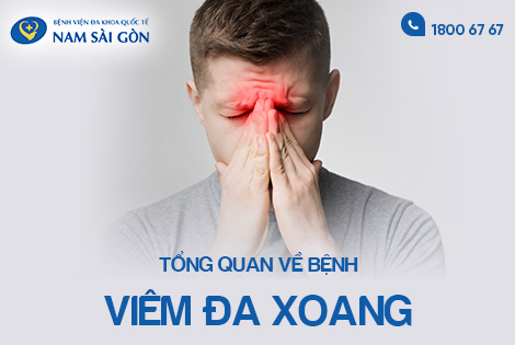 VIÊM ĐA XOANG – NGUYÊN NHÂN, DẤU HIỆU VÀ CÁCH ĐIỀU TRỊ