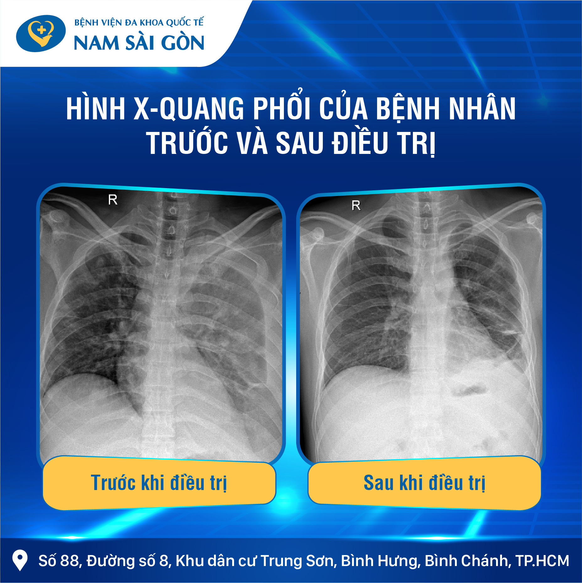 887_post_virus_an_thit_nguoi_op2_02-1 887 post virus an thit nguoi op2 02 1