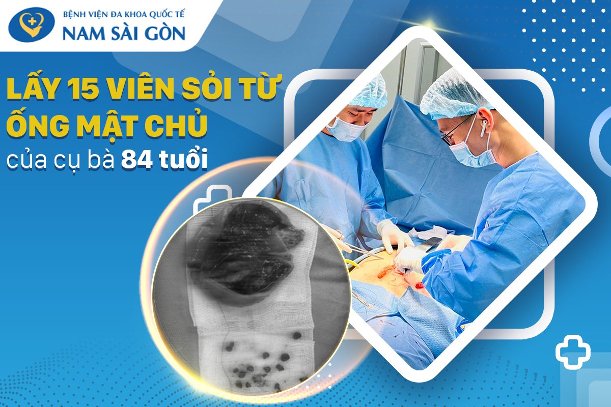 LẤY 15 VIÊN SỎI TỪ ỐNG MẬT CHỦ CỦA CỤ BÀ 84 TUỔI