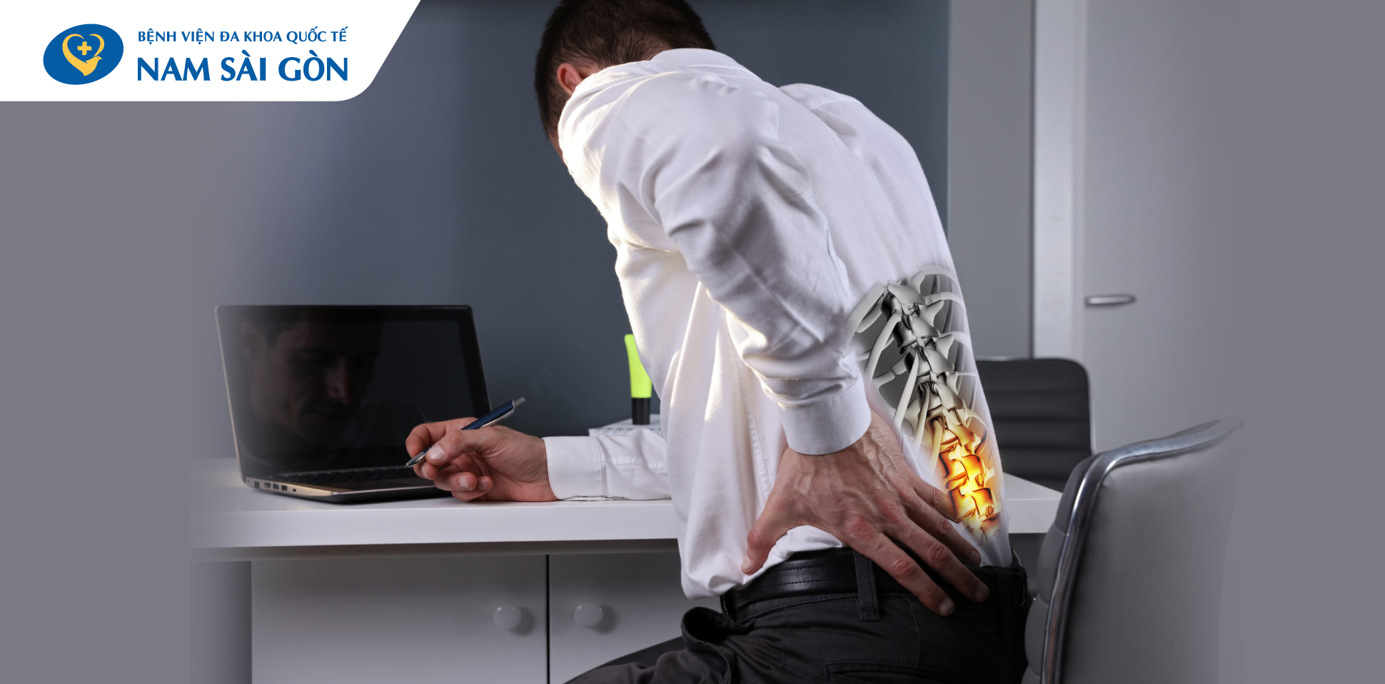 rễ thần kinh hội chứng rễ thần kinh