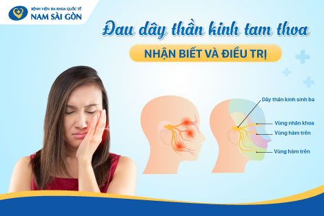 ĐAU DÂY THẦN KINH TAM THOA – NHẬN BIẾT TRIỆU CHỨNG VÀ ĐIỀU TRỊ